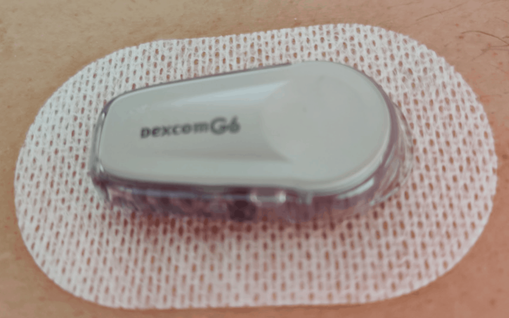 personal-experience-of-the-dexcom-g6-experience-after-using-it-1-month