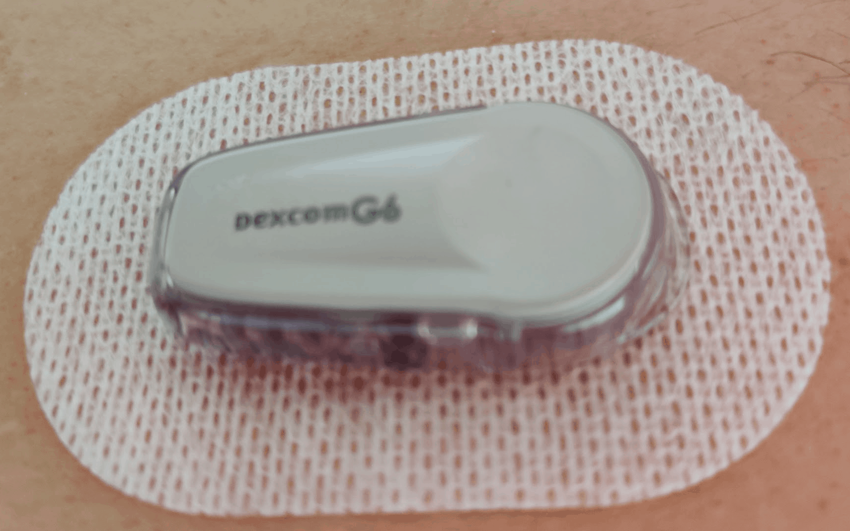 Dexcom G6 Experience after using it 1 month.